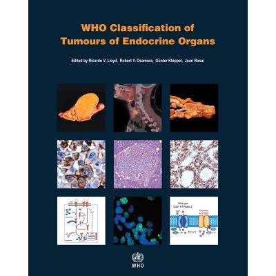 WHO Classification of Tumours of Endocrine Organs 世界卫生组织 内分泌器官肿瘤的分类 9789283244936