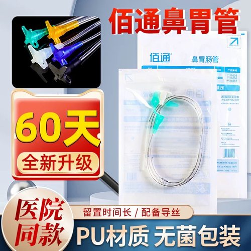 胃管带导丝经鼻喂养胃管留置60天