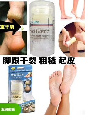 Heel Tastic 脚后跟干裂修复霜冬季脚油膏滋润脚裂膏去死皮美脚膏