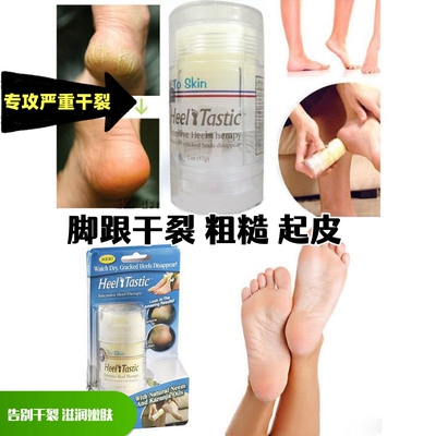 日用百货滋润脚裂膏脚油膏