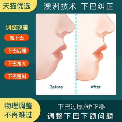 下巴后缩矫正器前突短下巴宽大长