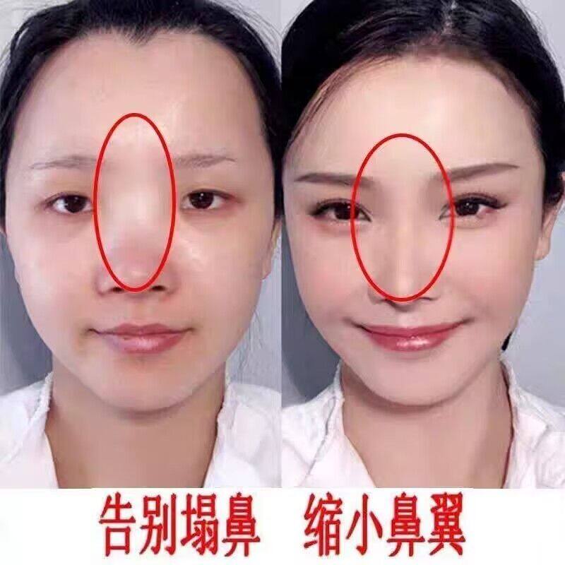 高鼻梁增山根瘦鼻头缩鼻翼女生大鼻头立体挺美鼻精华