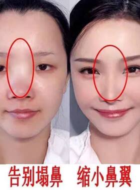 高鼻梁增山根瘦鼻头缩鼻翼女生大鼻头立体挺美鼻精华