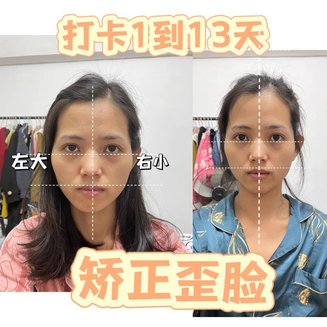 草本歪脸修复精华 矫正改善脸部偏移不规则