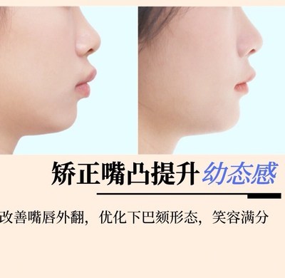 草本凸嘴修复精华  改善地包天嘴突露龈笑精油