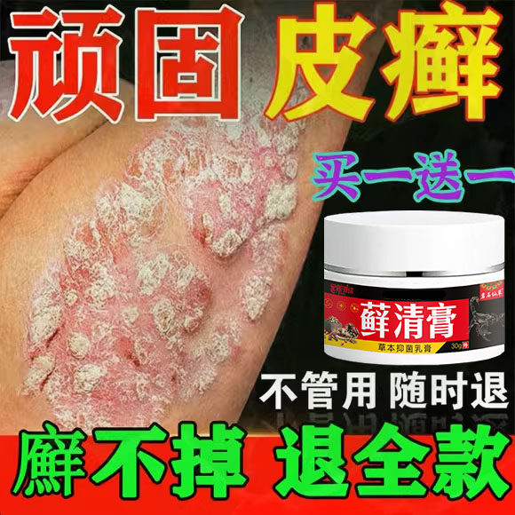 藓清膏治头皮屑藓皮炎牛皮银屑头部痒毛囊炎膏病真菌感染专用屑