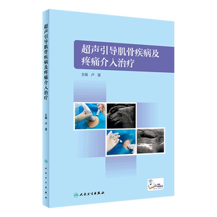 超声引导肌骨疾病及疼痛介入治疗(精)