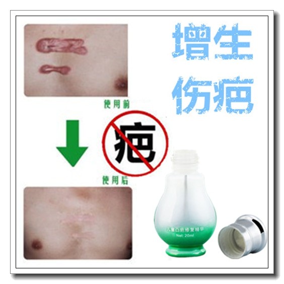 去刨妇产老疤祛除脸部黑色素痕美疤痕硅凝胶芦荟胶修复产品药膏贴,彩妆/香水/美妆工具,遮瑕,淘宝优惠券,粉丝福利购,淘宝优惠卷