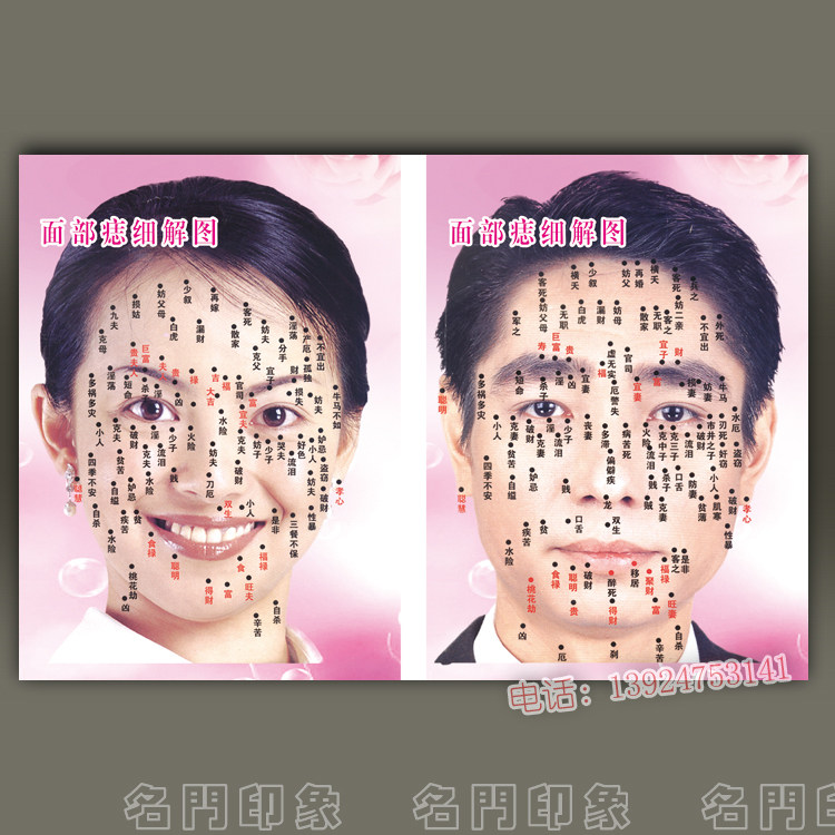 面部痣细解图无框画 美容院壁画装饰画 男女痣图挂画墙画图片海报
