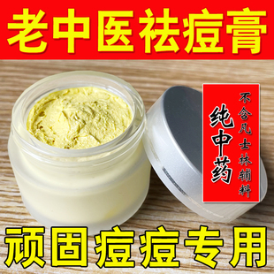 純中藥秘制草本祛痘藥膏青少年去痘正品 青春痘去豆豆消炎淡化痘印