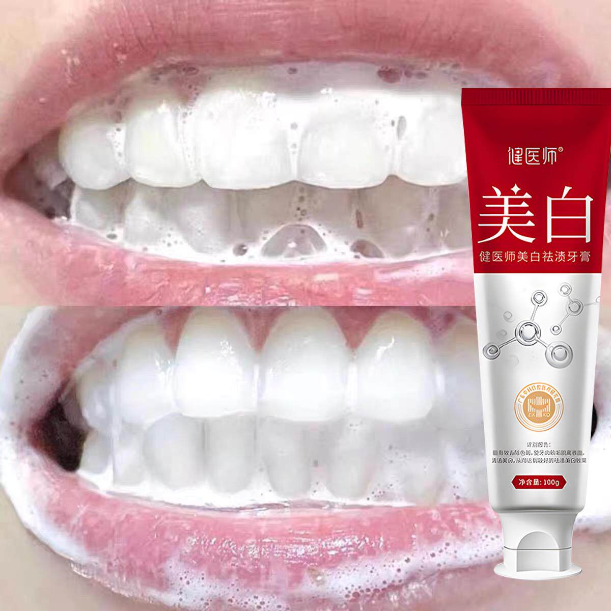 【快速亮白牙】美白去渍牙膏祛黄