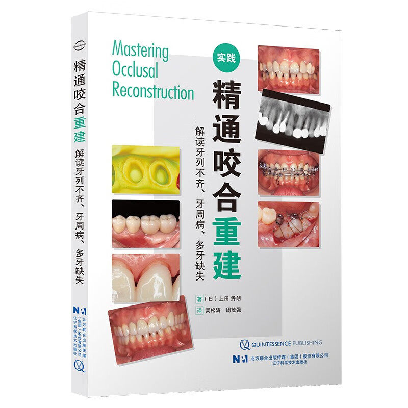 解读牙列不齐牙周病多牙缺失实践 精通咬合重建 口腔牙齿咬合重建方法实践手术学 牙科口腔科学 辽宁科学技术出版社 新华正版书籍