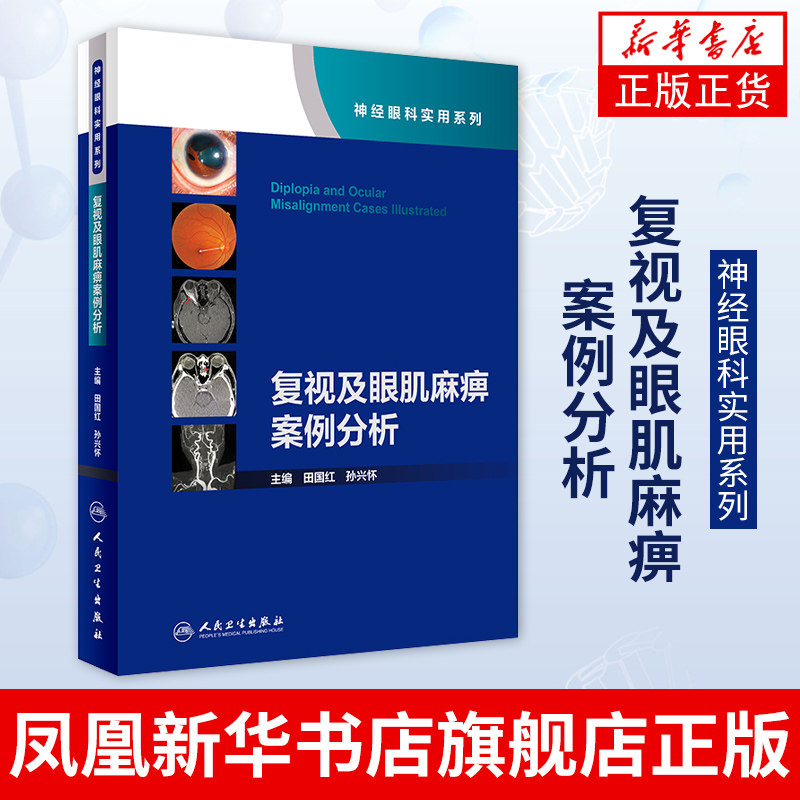 复视及眼肌麻痹案例分析(神经眼科实用系列)(配增值) 田国红 孙兴怀编 图例的形式分析病例 眼球运动视频 凤凰新华书店旗舰店