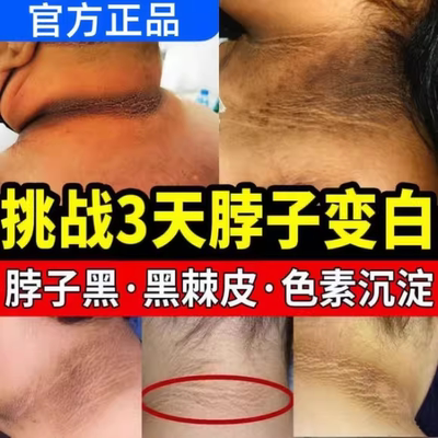 【皮肤黑克星】祛身上黑色素沉淀
