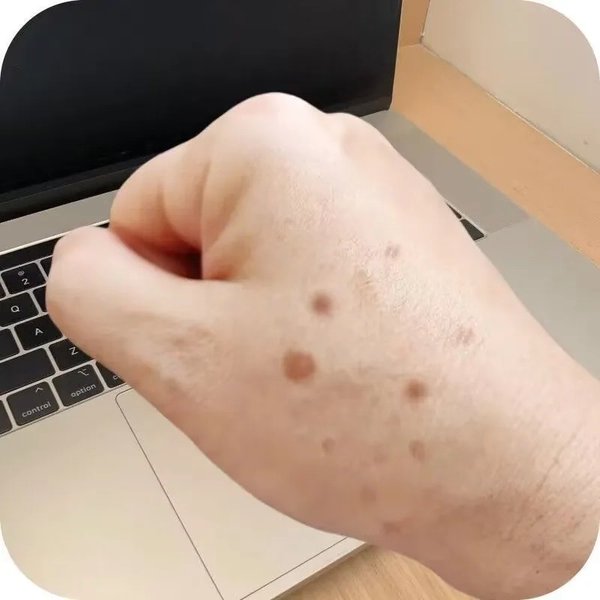 【一擦掉】斑点专用膏
