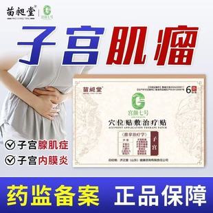 苗昶堂宫肌贴子宫肌瘤中药贴治疗腺肌症内膜宫颈炎糜烂痛经宫寒贴