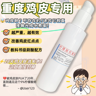重度鸡皮肤专用刷酸果酸身体乳膏甘醇酸疏通毛孔9%柠檬酸提亮