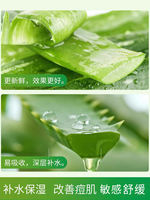 Aloe Vera Gel Official Flagship Store, Acne Mark and Pit Cream, Hydrating and Moisturizing, autumn and Winter Repair Gel, special for Women and men thumbnail 4