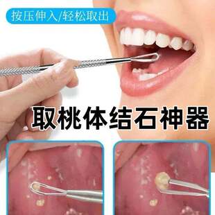 取扁桃体结石神器去除工具取出隐窝口腔扁条体扁桃腺扁导体石清理