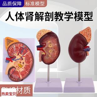 肾解剖附肾上腺放大模型病变肾脏 人体肾脏模型 S人体内脏器官解