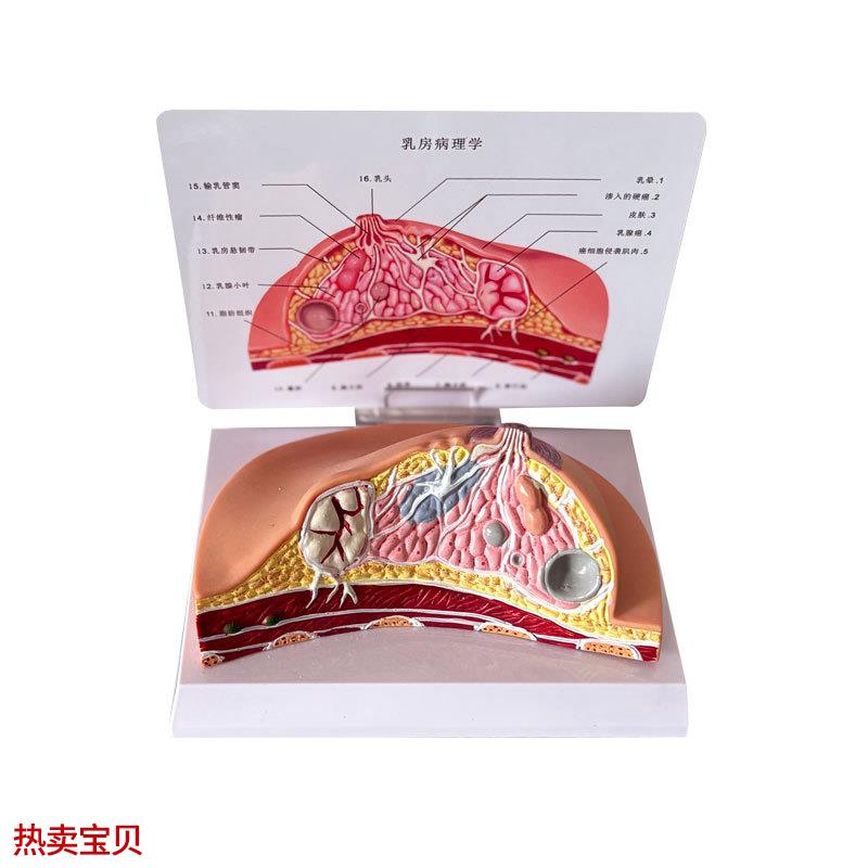 乳房模型乳腺增生家政培训妇产乳腺演示哺乳期乳房构X造催乳师教