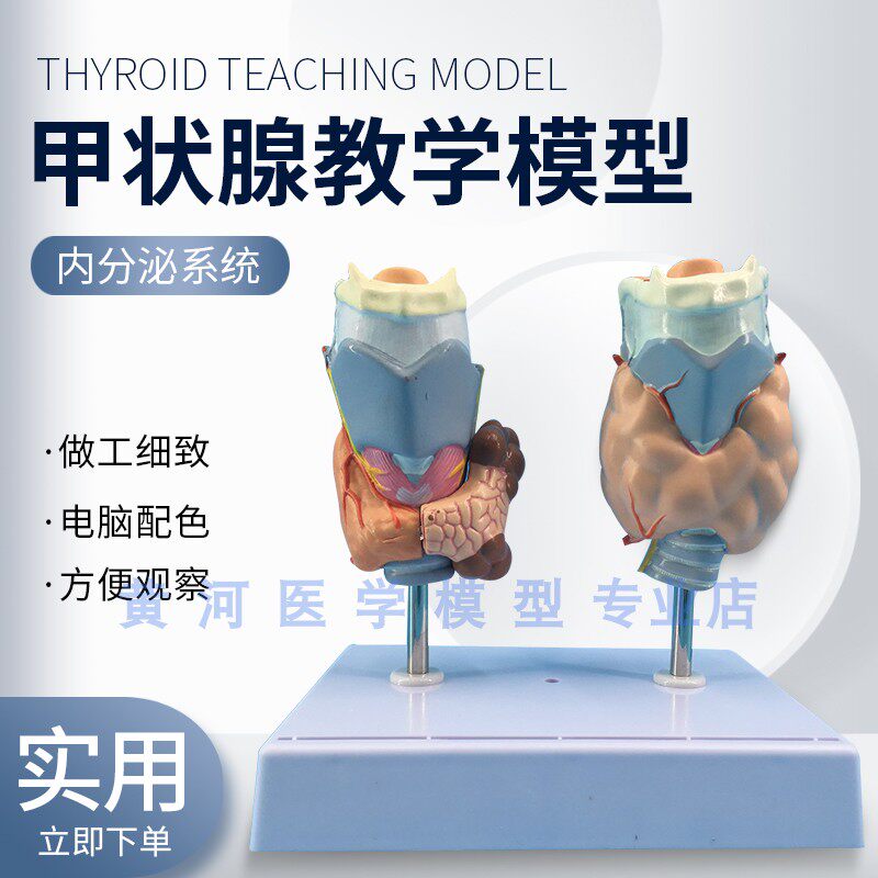 甲状腺病理模型 病态 喉头解剖z模型 甲状腺病变模型 甲状腺模型