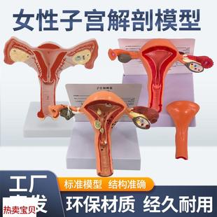 人体模型女性生殖子宫模型阴道卵巢模型教学模具病理变.化科普教