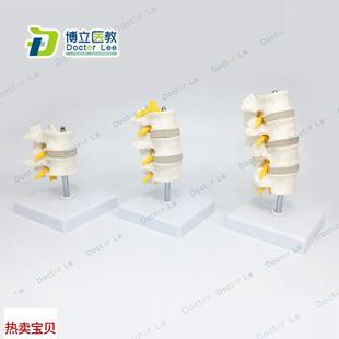 N椎间盘神经 厂家直销人体腰椎模型正常四节组合腰椎模型 骨科模