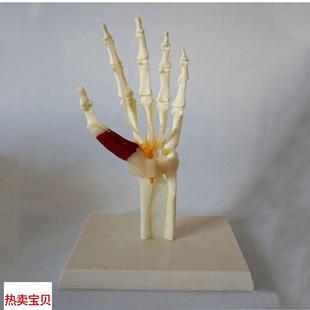 康泰手腕关节肌腱韧m带病理变形痛风类风滑膜关节僵硬肿胀侵蚀性