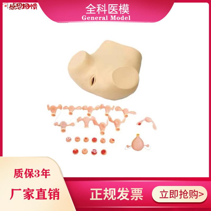 妇科检查训练模型脓肿积水宫p颈炎白斑息肉女性生殖器护理人模