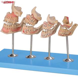 牙与颌骨的发育模型nB1000