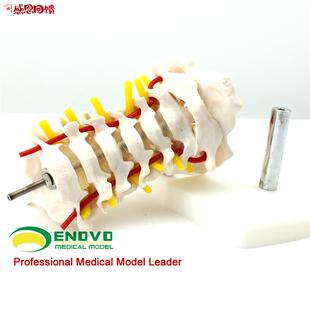 ENOVO颐诺 人体颈椎颈动脉模型颈v椎模型寰枢关节 人体骨骼标本
