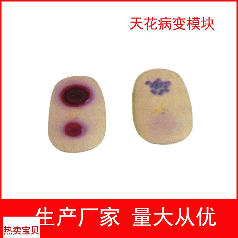 天花病变模块护h理模型天花病毒检查模型医学教学模型护士实习用