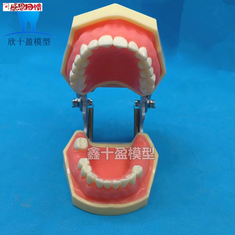牙科口腔种植 上颌窦加下颌窦种植v模型 练习切开种植缝合模型203