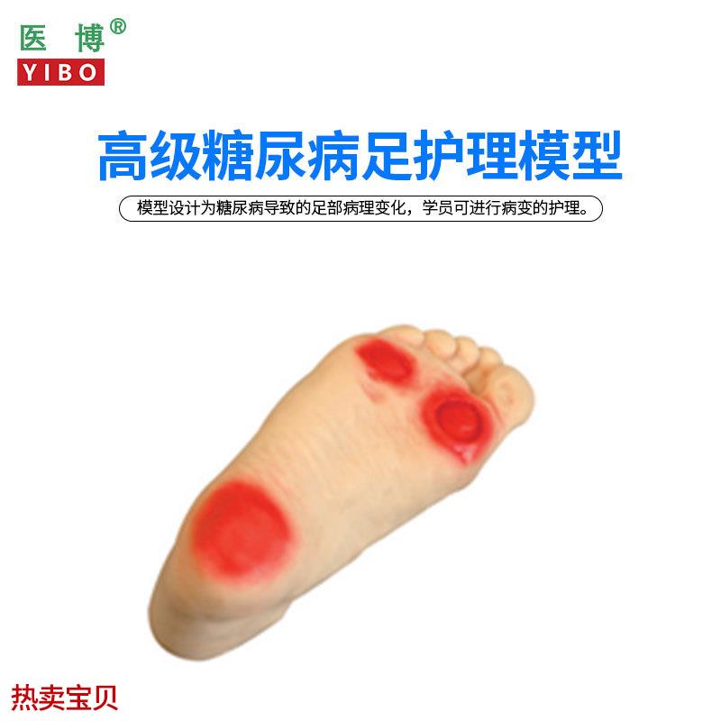 医博BIX-HS19 糖尿病足护理模型 L足部病理展示示教模型教具