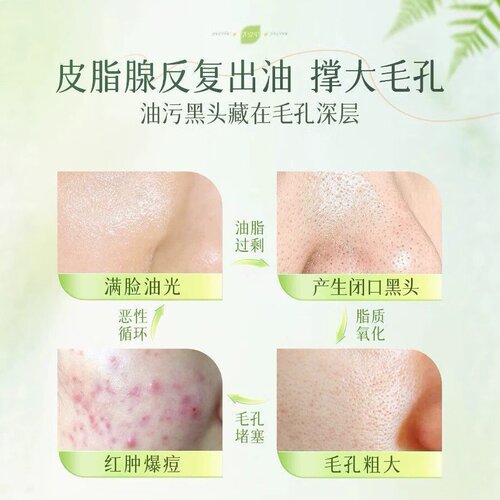 BUV叶绿素氨基酸洁面乳深层洁控油缩毛孔去黑头小绿泥洗面奶