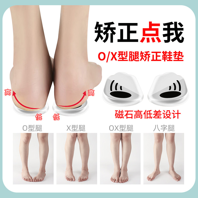 o型腿矫正鞋垫罗圈腿矫正器xo腿型小腿外翻纠正改善x型腿神器儿童