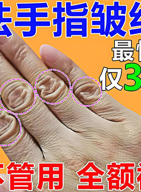 去手指关节皱纹祛除手粗糙干燥手背暗沉黑修复手纹护手霜保湿嫩肤