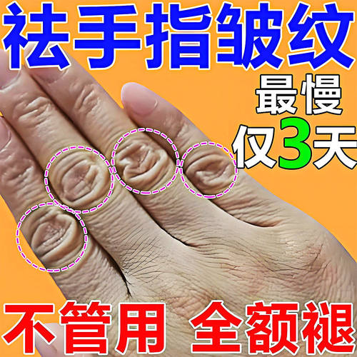 去手指关节皱纹祛除手粗糙干燥手背暗沉黑修复手纹护手霜保湿嫩肤