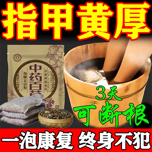 脚指甲发黄变厚真菌感染专用药