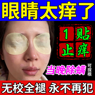 眼睛痒除螨眼贴干涩发痒治疗眼角里面过敏性眼痒去除螨虫清洁止痒