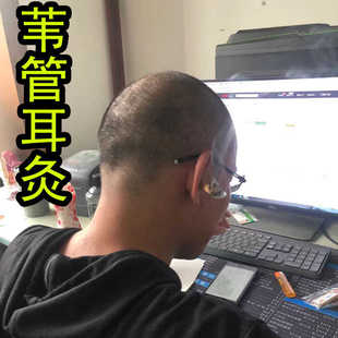 苇管器灸耳朵艾炙耳部耳灸仪器耳疗工具美容院缓解耳M耳L中耳Y面T