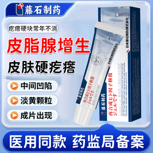 藤石制药面部鼻子皮脂腺增生去除膏鼻翼凸起小疙瘩肉粒药监备案YU