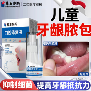 根尖牙龈脓包肿痛消炎专用治牙根发炎牙周炎智齿冠鼓包药监备案ZY