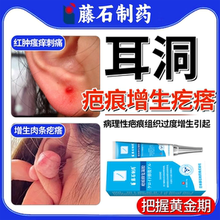 藤石制药耳洞增生疤痕疙瘩凸起硬肉软化针可搭止软化痒乳膏去除ON