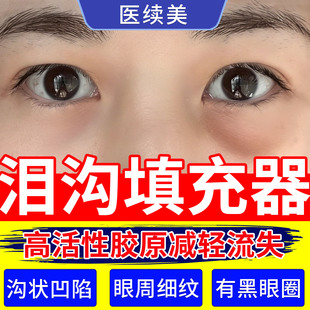 泪沟填充神器眼窝凹陷修复医用三型胶原蛋白面部法令纹眼霜消除ZY