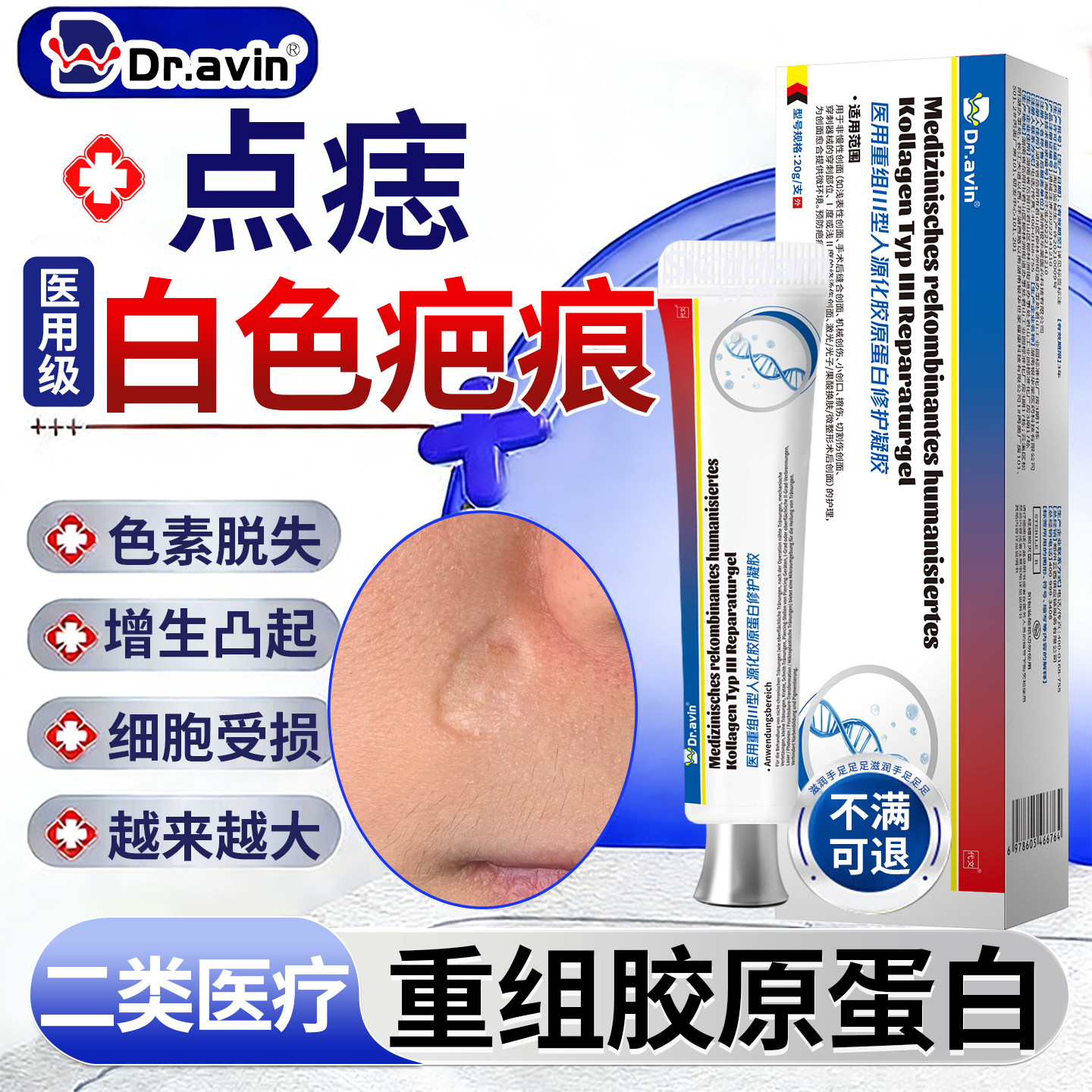点痣白色疤痕色素脱失沉淀淡化去除增生凸起疙瘩修儿童复祛疤膏YU