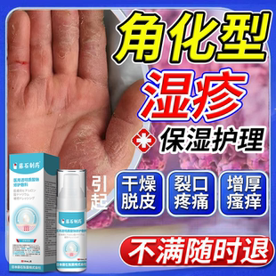 角化型手部皲裂性湿疹手癣引起脱皮干裂瘙痒真菌感染药监备案膏LJ
