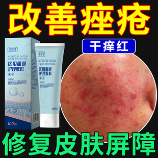 痤疮敷料修复皮肤屏障护肤品毛细血管扩张大红脸红痒烫专用玫瑰ON