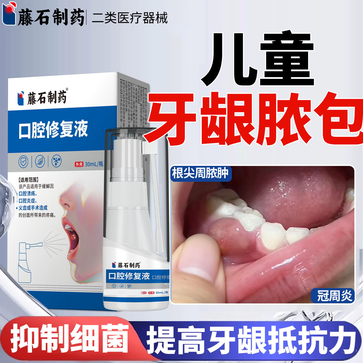根尖牙龈脓包肿痛消炎专用治牙根发炎牙周炎智齿冠鼓包药监备案ZY
